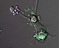 Phagocyte Eating Dying Cells