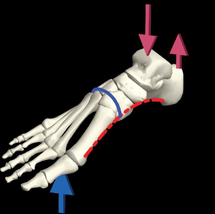 Schematic of the Foot Skeleton Showing the Arches and Typical Loading Pattern during Locomotion