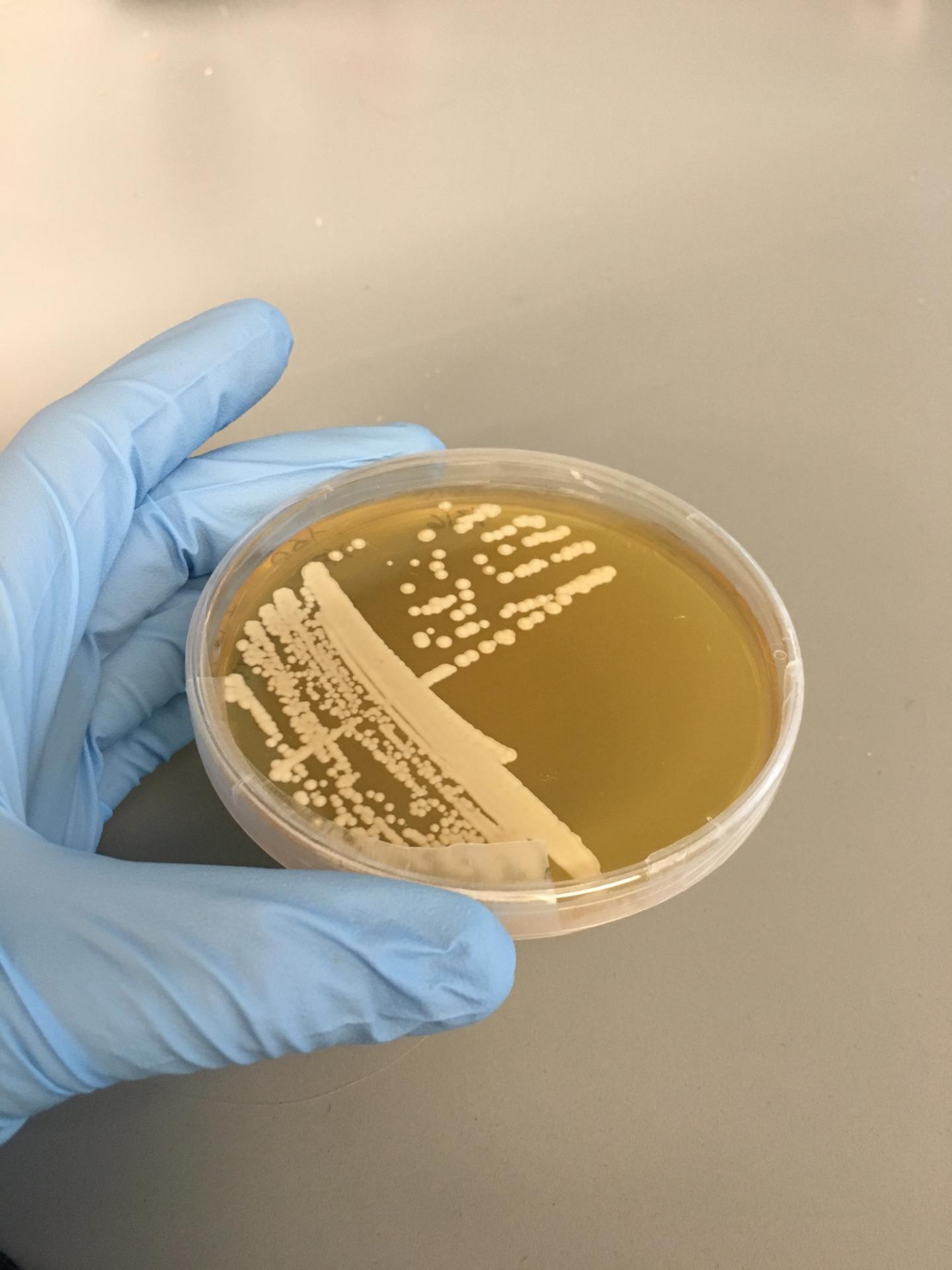 Yeast from iInsects