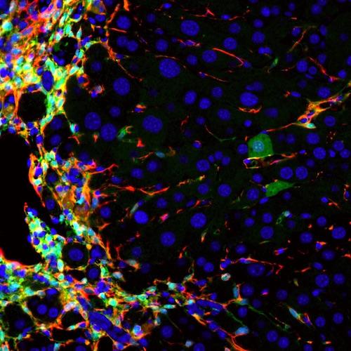 New Technique Could Repair Liver Disease from Within
