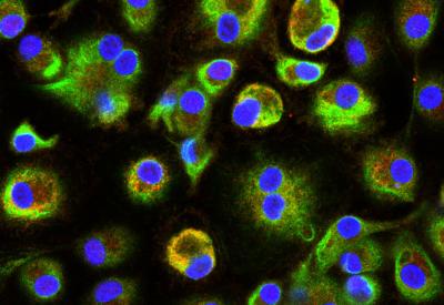 Immunofluorescence Staining for PARP9 and PARP14