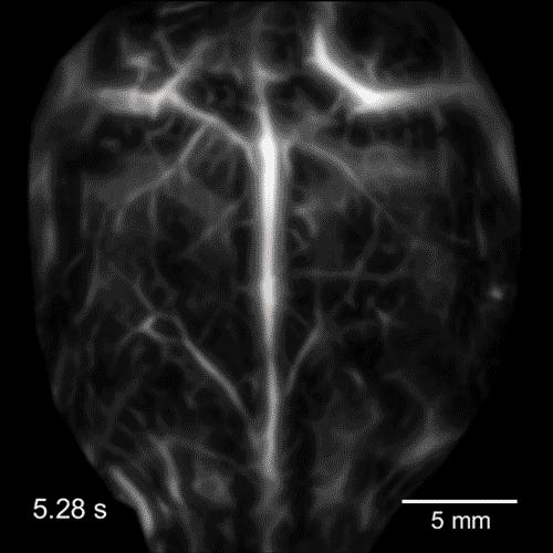 Live Brain with Neurons Firing
