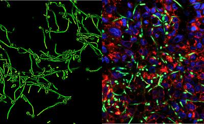 Virulent <i>Candida albicans</i>