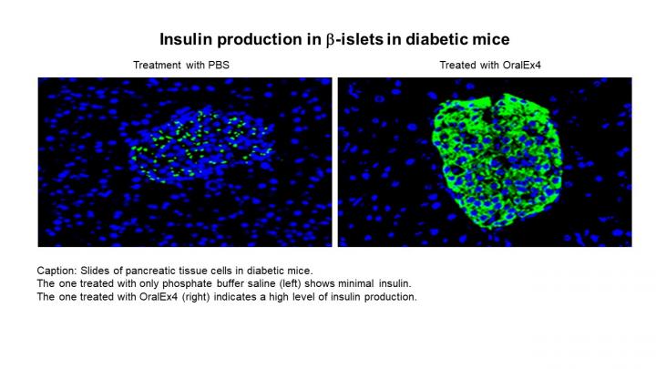 Insulin Production in Diabetic Pancreatic Tissue Cells