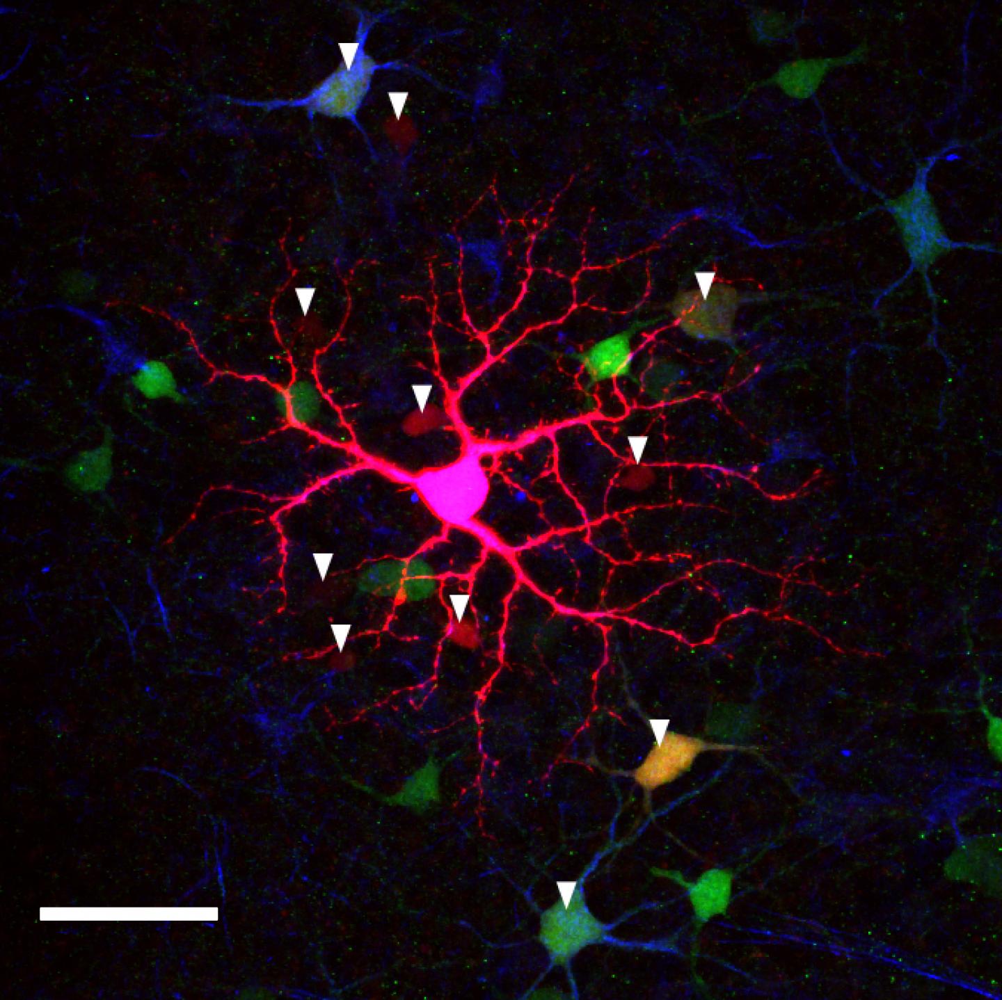 Intrinsically Photosensitive Retinal Ganglion Cell (ipRGC)