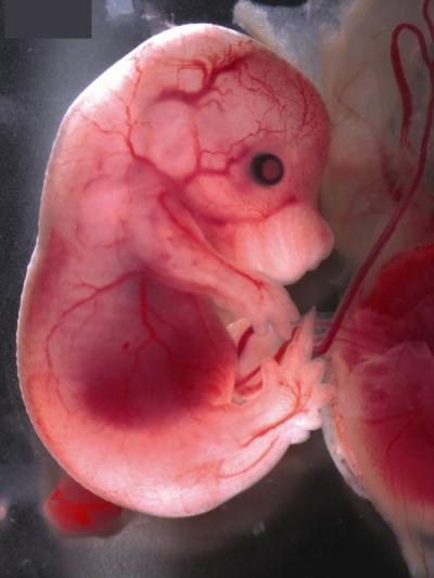 Origins of Blood Stem Cells