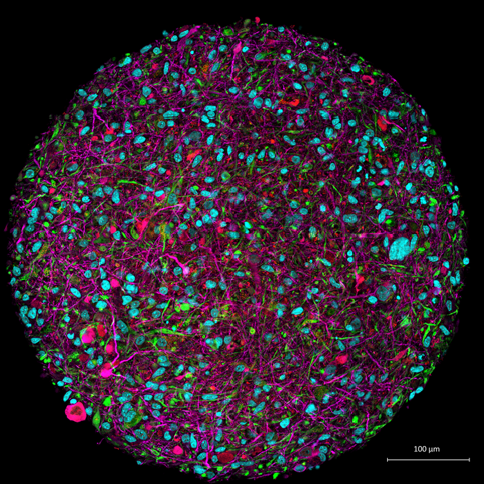 Lab-grown brain organoid