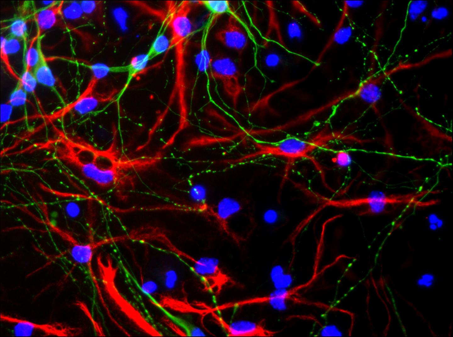 Fluorescent Microscopy of Mouse Embryonic Neurons and Astrocytes