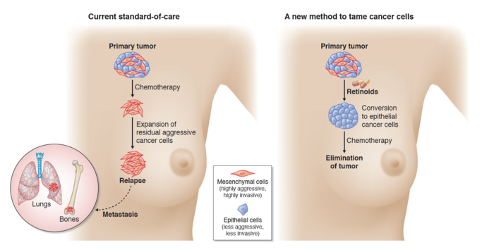 Transforming Breast Cancer Together: Bridging the Gap in Breast