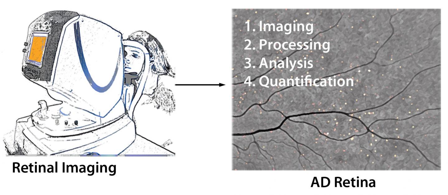 Presumed Amyloid Plaques