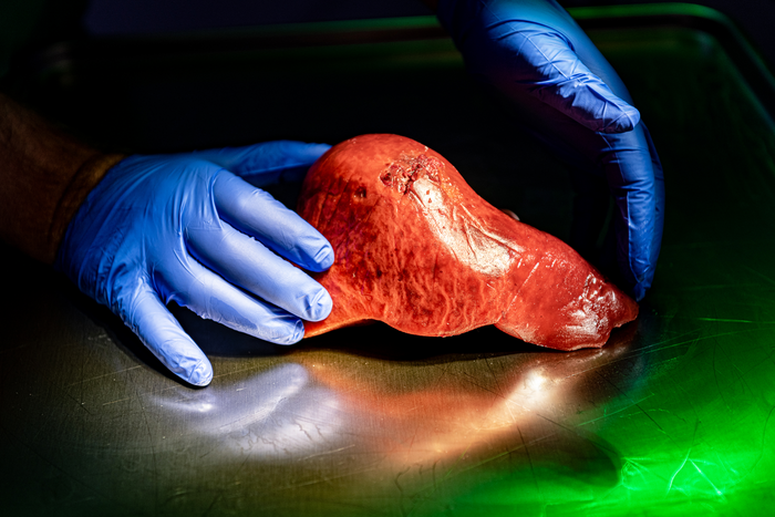 3D-printed liver model