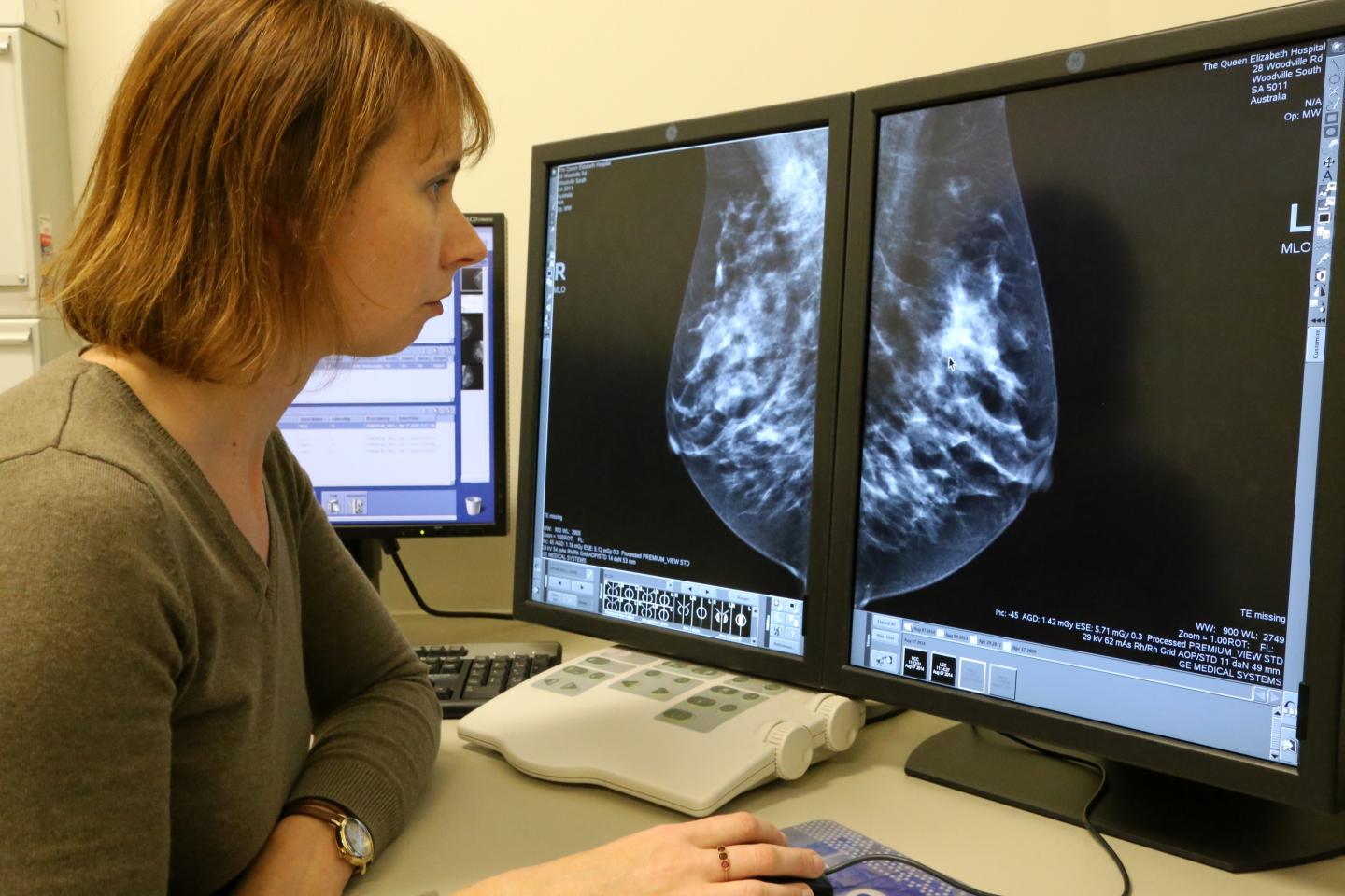 Measuring breast density