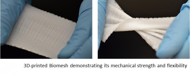 3D-printed Biomesh