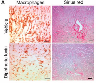 When Healing Goes Haywire: Protein Found that Slows Fibrosis (2 of 4)