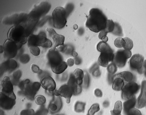 Differentiated human intestinal organoids