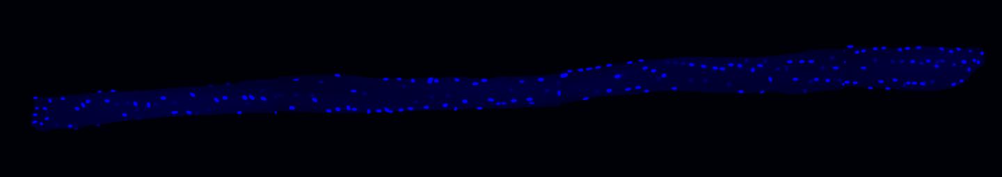 Whole muscle fiber