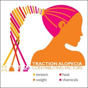 Traction Alopecia