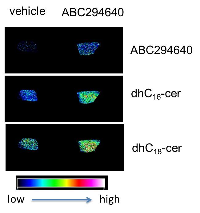 Accumulation of dihydroceramides after ABC294640 administration
