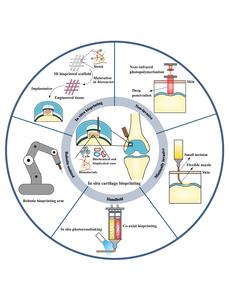 Schematic of the key strategies for in situ cartilage bioprinting