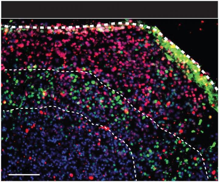 Layered Cellular Structure in Human Cortical Spheroid