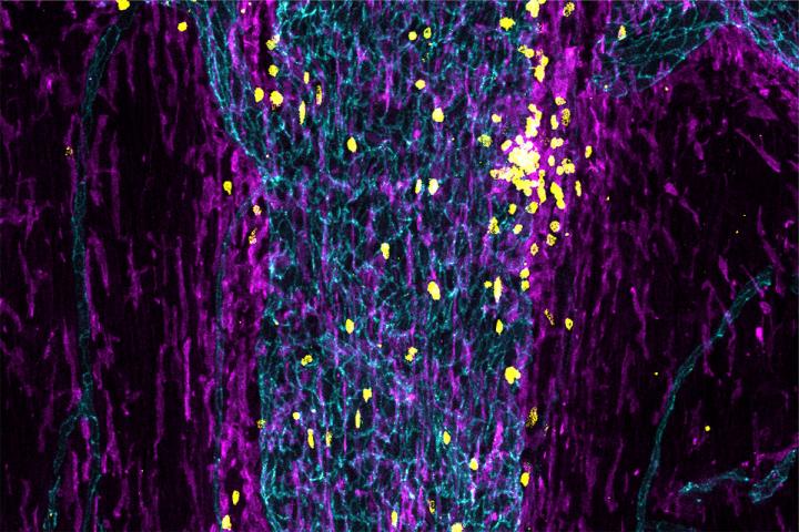 Immune cells in dural sinuses