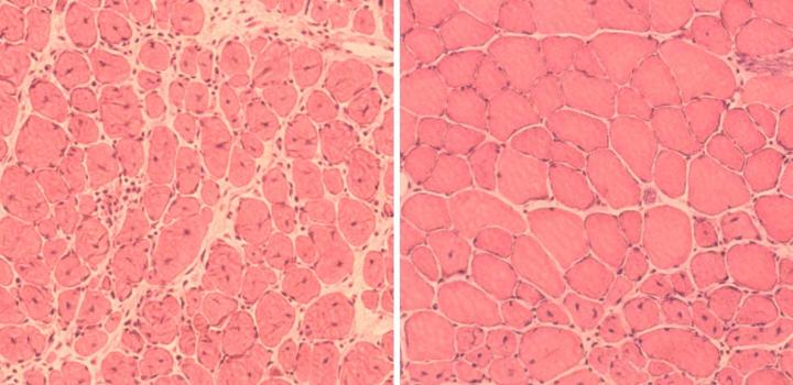 Improved Muscle Regeneration in Aged Mice