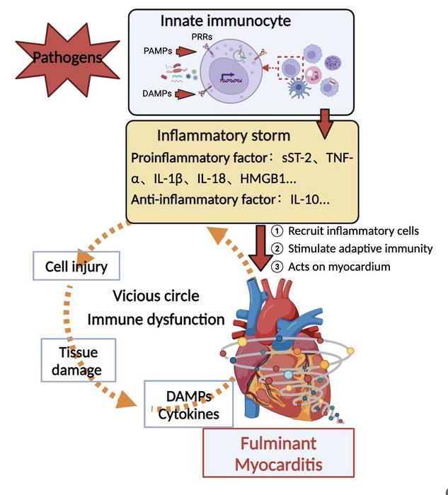 Inflammatory storm formation in patients with fulminant myocarditis