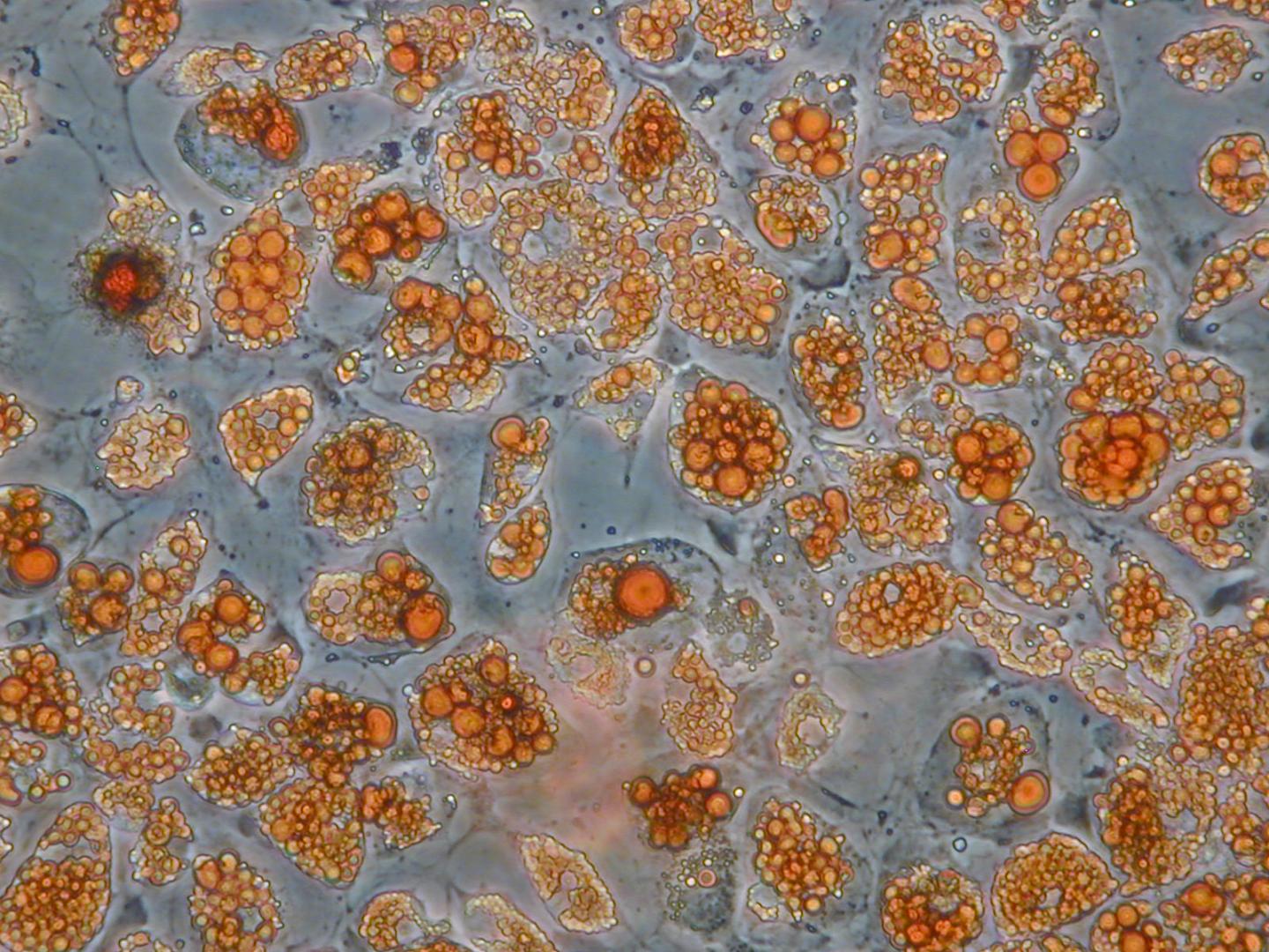 Lsd1 Ablated in Adipocytes