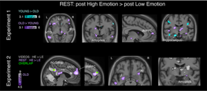 Managing emotions better could prevent pathological ageing