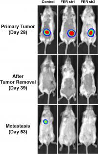 Supressing FER Reduces Metastasis