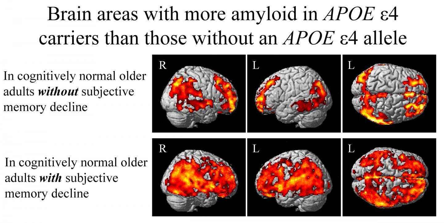 Brain Areas with More Amyloid in APOE e4 Carriers Than Those without APOE e4 Allele