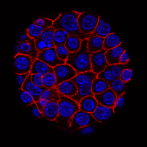 Pancreatic Cancer Cell