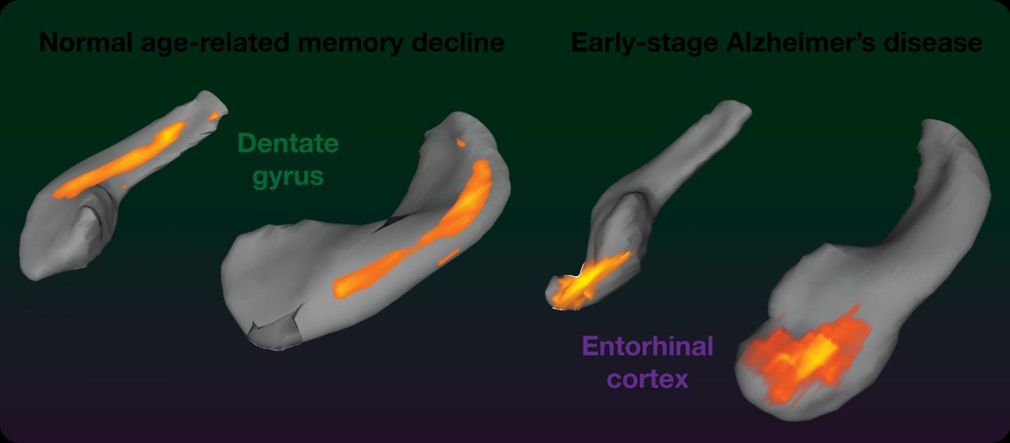 Changes in the Dentate Gyrus are Associated with Normal Age-Related Memory Decline