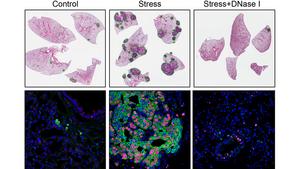 cancer cells in mice