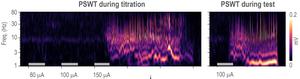 Seizure currents