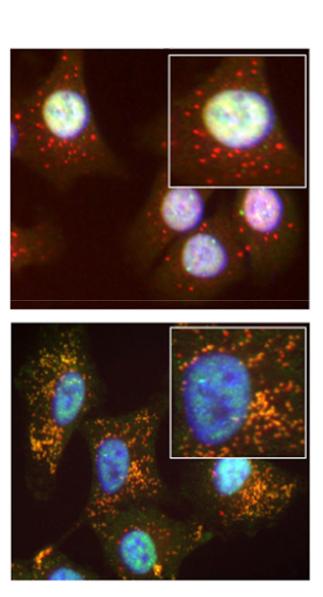 Targeting a Transcription Factor May Help Asthmatics Breathe Easiere (1 of 4)