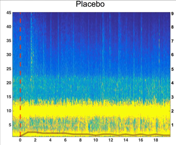 Brainwaves Measured by EEEG under Control Conditions