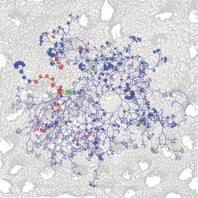 Gut Bacteria Aid Cancer Therapies (2 of 4)