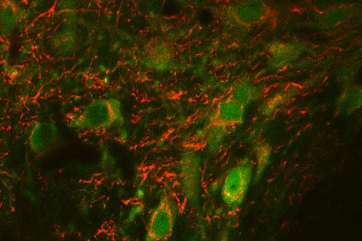 Study Finds Surprising Response to Cocaine in Unique Strain of Mutant Mice