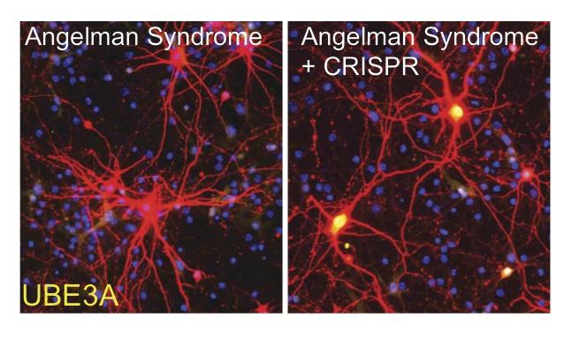 ANGELMAN_CRISPR-CAS-9