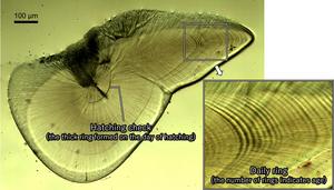 Statolith growth rings