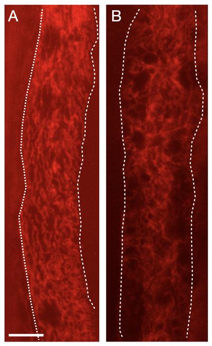 Mitochondrial response to pathogenic odors