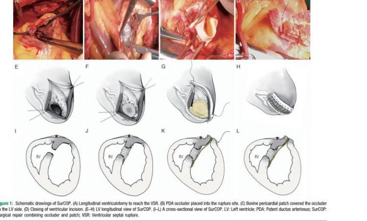 Repairing "Broken" Hearts