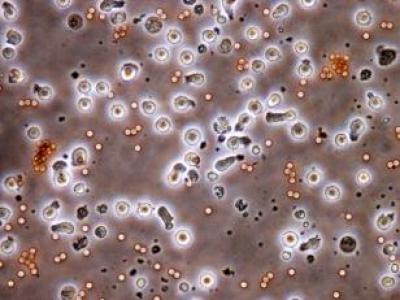 Rejuvenated T cells Dedifferentiated from T-iPSCs