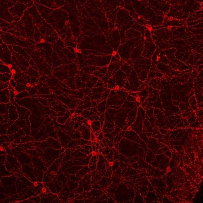 Perfect Vision But Blind To Light