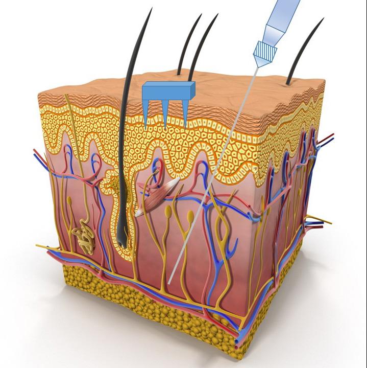 A Diagram of Human Skin and Mi [IMAGE] | EurekAlert! Science News Releases