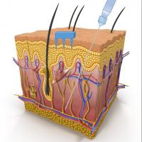 A Diagram of Human Skin and Microneedles