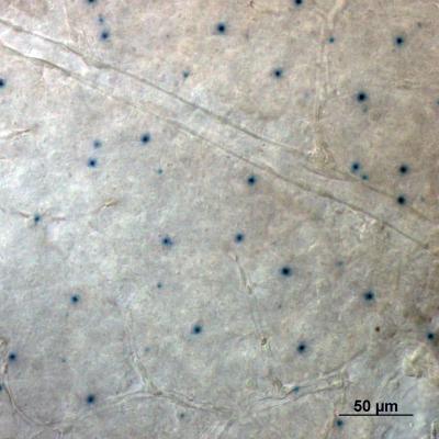 Neuropsin in the Retina