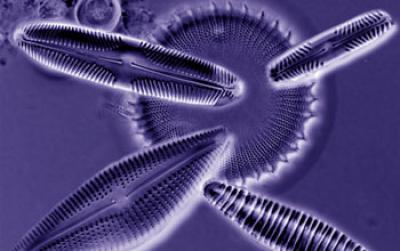 Photomicrograph of Algae in an Aquatic Ecosystem