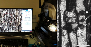 Microscopic observation of a section of Devonian fossil wood containing tyloses